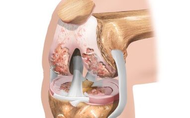 The ligament scheme