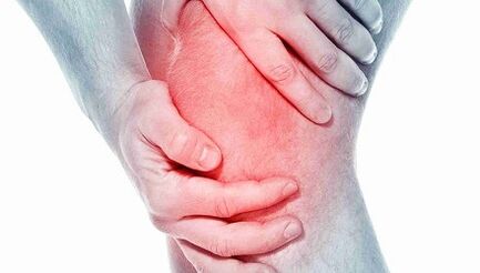 Arthritis