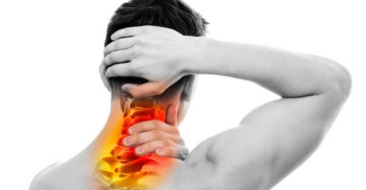 Neck pain and nape signs of osteochondrosis